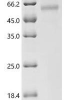 Macaca fascicularis Dipeptidase 3 (DPEP3) Recombinant Protein, C-His, aa 36–463, Macaca fascicularis (Crab-eating macaque) (Cynomolgus monkey) - BioCrest Sci