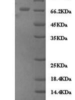 Human Zyxin (ZYX) Recombinant Protein - BioCrest Sci