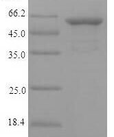 Chlamydia trachomatis serovar L2 Major outer membrane porin (ompA) Recombinant Protein - BioCrest Sci