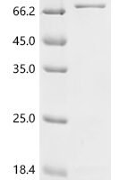 Escherichia coli Cytoplasmic trehalase (treF) Recombinant Protein, C-His - BioCrest Sci