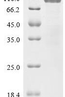 Human Atrial natriuretic peptide receptor 1 (NPR1), partial Recombinant Protein, C-hFc1 - BioCrest Sci