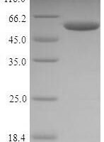 Mouse Nucleophosmin (Npm1) Recombinant Protein - BioCrest Sci