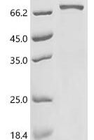 Human Dihydropyrimidinase-related protein 5 (DPYSL5) Recombinant Protein, C-His - BioCrest Sci