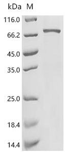 Human Dihydropyrimidinase-related protein 5 (DPYSL5) Recombinant Protein, C-His, Homo sapiens (Human), Homo sapiens (Human), C-terminal 6xHis-tagged, 62.2 kDa, purity >≥ 85% as determined by SDS-PAGE.