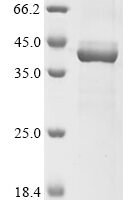 Human Epoxide hydrolase 3 (EPHX3), partial Recombinant Protein - BioCrest Sci