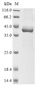 Human Epoxide hydrolase 3 (EPHX3), partial Recombinant Protein, Homo sapiens (Human), E.coli, N-terminal 10xHis-tagged and C-terminal Myc-tagged, 43.9 kDa, purity >≥ 85% as determined by SDS-PAGE.