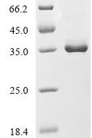 Mouse Proepiregulin (Ereg), partial Recombinant Protein, N-hFc1 - BioCrest Sci