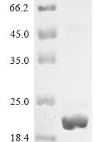 Human C-Jun-amino-terminal kinase-interacting protein 4 (SPAG9), partial Recombinant Protein - BioCrest Sci