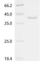 Vaccinia virus Protein C15/B21 Recombinant Protein - BioCrest Sci
