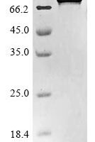 Human Dystroglycan (DAG1), partial Recombinant Protein, N-10His/C-Myc, aa 30–653, E.coli - BioCrest Sci