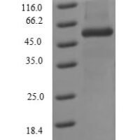 Influenza A virus Nucleoprotein (NP) Recombinant Protein, N-His, aa 1–498, strain A/Kitakyushu/159/1993 H3N2 - BioCrest Sci