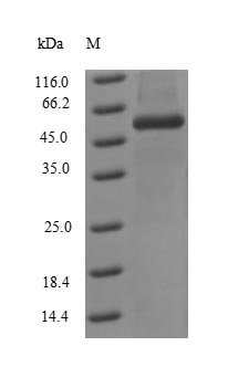 Influenza A virus Nucleoprotein (NP) Recombinant Protein, N-His, aa 1–498, strain A/Kitakyushu/159/1993 H3N2, Influenza A virus (strain A/Kitakyushu/159/1993 H3N2), E.coli, N-terminal 6xHis-tagged, 60.2 kDa, purity >≥ 90% as determined by SDS-PAGE.