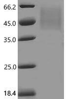 Macaca mulatta V-set domain containing T cell activation inhibitor 1 (VTCN1), partial Recombinant Protein - BioCrest Sci