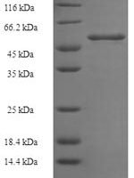 Plasmodium falciparum Multidrug resistance protein (MDR1), partial Recombinant Protein, N-His-SUMO - BioCrest Sci
