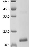 Human Tetraspanin-1 (TSPAN1), partial Recombinant Protein - BioCrest Sci
