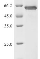 Human Cartilage matrix protein (MATN1) Recombinant Protein - BioCrest Sci