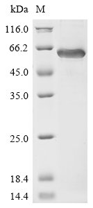 Human Cartilage matrix protein (MATN1) Recombinant Protein, Homo sapiens (Human), E.coli, N-terminal 6xHis-tagged, 57.3 kDa, purity >≥ 85% as determined by SDS-PAGE.