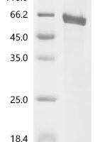 Human Leucine-rich repeat-containing G-protein coupled receptor 4 (LGR4), partial Recombinant Protein, N-His/C-Avi - BioCrest Sci