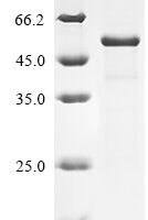 Gossypium hirsutum transcription factor bHLH84-like (LOC107908183) Recombinant Protein - BioCrest Sci