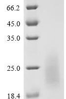 Human herpesvirus 2 E3 ubiquitin-protein ligase ICP0 (RL2),partial Recombinant Protein - BioCrest Sci