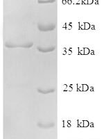 Human NADH dehydrogenase [ubiquinone] 1 alpha subcomplex subunit 2 (NDUFA2), partial Recombinant Protein - BioCrest Sci