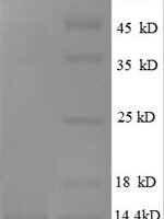 Human Growth-regulated alpha protein (CXCL1) Recombinant Protein, N-His - BioCrest Sci