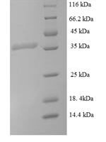 Mycobacterium tuberculosis Signal peptidase I (lepB), partial Recombinant Protein, N-His-SUMO - BioCrest Sci