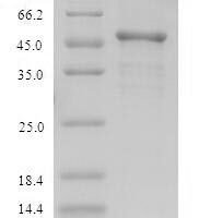 Rhodobacter sphaeroides Modification methylase RsrI (rsrIM) Recombinant Protein - BioCrest Sci