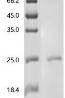 Saccharomyces cerevisiae Lipid-anchored plasma membrane protein CPP1 (CPP1) Recombinant Protein, C-His - BioCrest Sci