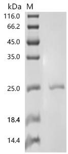 Saccharomyces cerevisiae Lipid-anchored plasma membrane protein CPP1 (CPP1) Recombinant Protein, C-His, Saccharomyces cerevisiae (strain ATCC 204508 / S288c) (Baker's yeast), E.coli, C-terminal 6xHis-tagged, 21.4 kDa, purity >≥ 90% as determined by SDS-PAGE.