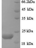 Human Caspase-8 (CASP8), partial Recombinant Protein, N-His, aa 217–374, E.coli - BioCrest Sci