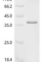 Mouse H-2 class II histocompatibility antigen, A-B alpha chain (H2-Aa), partial Recombinant Protein, C-His, aa 24–218, E.coli - BioCrest Sci