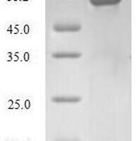 Human Glutaredoxin-3 (GLRX3) Recombinant Protein - BioCrest Sci