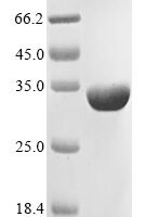 Nostoc sp. All1616 protein (all1616) Recombinant Protein - BioCrest Sci