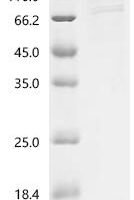 Human Sodium/potassium-transporting ATPase subunit alpha-1 (ATP1A1), partial Recombinant Protein, C-10His-HSA - BioCrest Sci