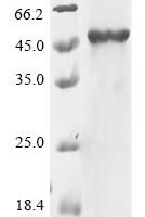 Human Putative pregnancy-specific beta-1-glycoprotein 7 (PSG7) Recombinant Protein, N-His - BioCrest Sci
