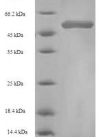 Actinidia deliciosa Fruit protein pKIWI502 (pKIWI502) Recombinant Protein - BioCrest Sci