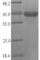 Human Nectin-2 (PVRL2), partial Recombinant Protein - BioCrest Sci