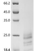 Human Myosin regulatory light chain 12B (MYL12B) Recombinant Protein, C-10His - BioCrest Sci