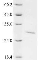 Mouse Granzyme K (Gzmk) Recombinant Protein, C-His - BioCrest Sci