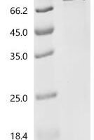 Human Zinc finger protein 395 (ZNF395) Recombinant Protein - BioCrest Sci