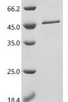 Human Oxaloacetate tautomerase FAHD1, mitochondrial (FAHD1) Recombinant Protein, N-GST - BioCrest Sci