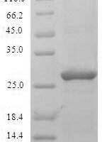 Phleum pRatense Pollen allergen Phl p 2 (PHLPII) Recombinant Protein - BioCrest Sci