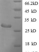 Escherichia coli Adenylate kinase (adk) Recombinant Protein - BioCrest Sci