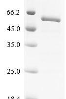 Human Cytochrome P450 11B1, mitochondrial (CYP11B1) Recombinant Protein, C-His - BioCrest Sci