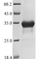 Human DNA polymerase theta (POLQ), partial Recombinant Protein, N-10His/C-Myc, aa 321–554 - BioCrest Sci