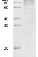 Human Solute carrier family 23 member 2 (SLC23A2)-Detergent Recombinant Protein - BioCrest Sci
