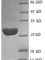 Human Elongation factor Tu, mitochondrial (TUFM), partial Recombinant Protein - BioCrest Sci