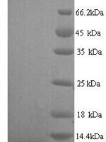 Human Pulmonary surfactant-associated protein C (SFTPC) Recombinant Protein, N-His, aa 24–58, Yeast - BioCrest Sci