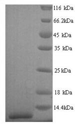 Human Pulmonary surfactant-associated protein C (SFTPC) Recombinant Protein, N-His, aa 24–58, Yeast, Homo sapiens (Human), Yeast, N-terminal 6xHis-tagged, 5.7 kDa, purity >≥ 90% as determined by SDS-PAGE.